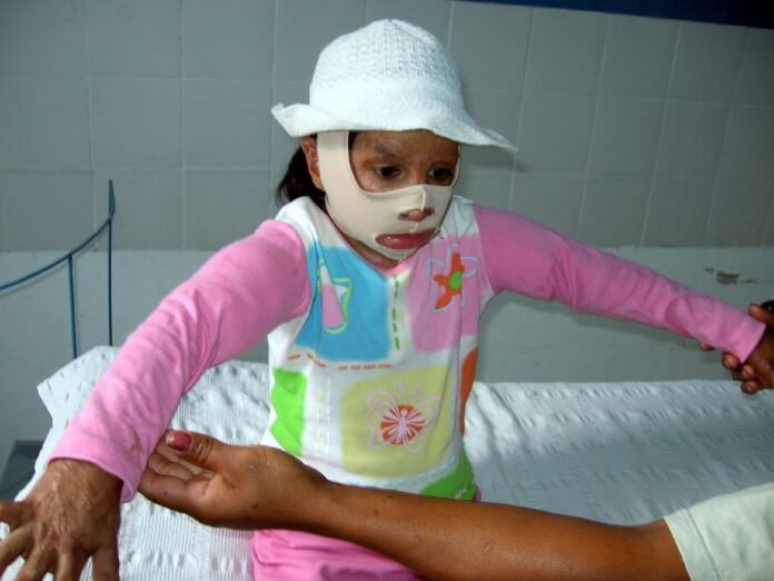Burn and Plastic Surgery